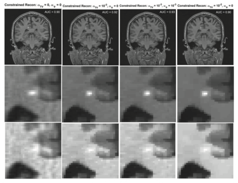 MRI images