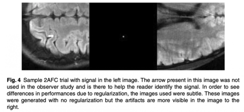 MRI images in figure from article