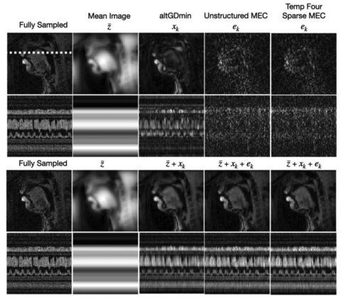 MRI images