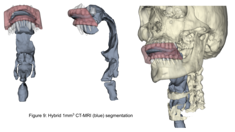 Hybrid CT-MRI segmentation