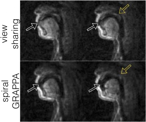 Figure from journal article