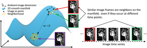 manifold-learning-dynamic MRI