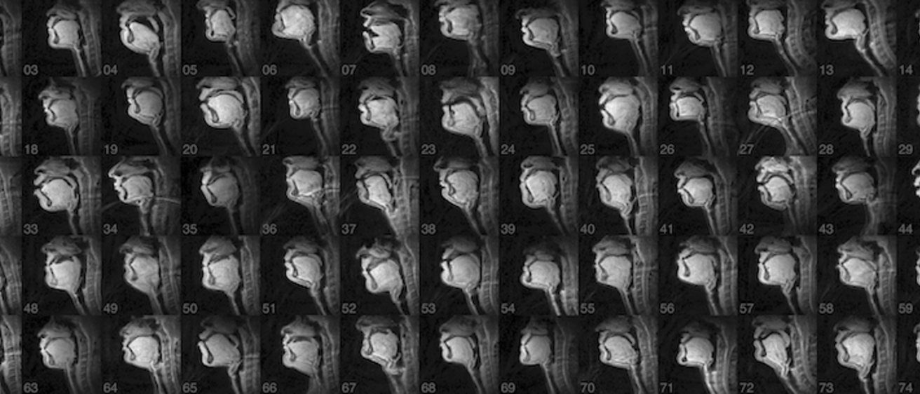MRI images of speakers